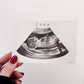 Custom Sonogram Watercolor Painting