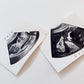 Custom Sonogram Watercolor Painting